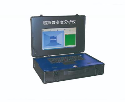 超聲骨密度分析儀 超聲骨密度分析儀